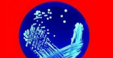 Introduction to Bacteriology – Kristy June
