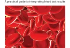 Blood Results in Clinical Practice: A Practical Guide to Interpreting Blood Test Results, 2nd Edition