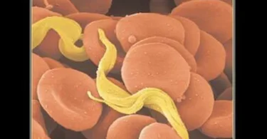 Human Parasitology, 3rd Edition