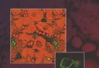 Immunology and Immunopathogenesis of Malaria
