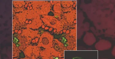 Immunology and Immunopathogenesis of Malaria