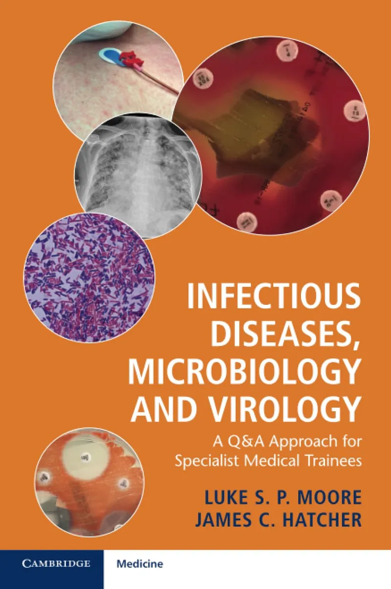 Infectious Diseases, Microbiology and Virology A Q&A Approach for Specialist Medical Trainees