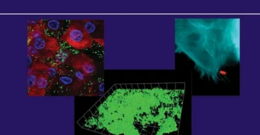 Molecular Paradigms of Infectious Disease: A Bacterial Perspective