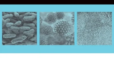 Oxford Case Histories in Infectious Diseases and Microbiology, (Oxford University Press)