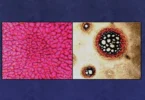 Pathological Blood Coagulation: The Myxotoxic Oxidative Stress Test