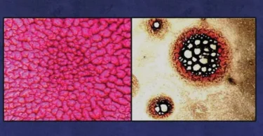 Pathological Blood Coagulation: The Myxotoxic Oxidative Stress Test