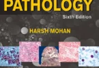 Textbook of Pathology With Pathology Quick Review and MCQs, Sixth Edition