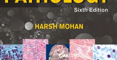 Textbook of Pathology With Pathology Quick Review and MCQs, Sixth Edition