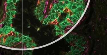 The Biology of Cancer, 2nd Edition