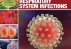 The Microbiology of Respiratory System Infections, Volume 1