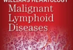 Williams Hematology Malignant Lymphoid Diseases