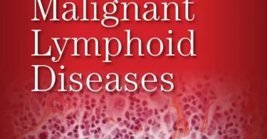 Williams Hematology Malignant Lymphoid Diseases