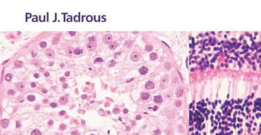 Diagnostic Criteria Handbook in Histopathology: A Surgical Pathology Vade Mecum