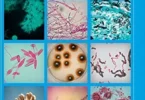 Identification of Pathogenic Fungi, Second Edition