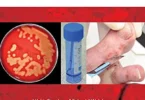Medical Microbiology Testing in Primary Care
