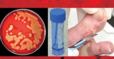 Medical Microbiology Testing in Primary Care