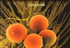 Pathophysiology 5th Edition