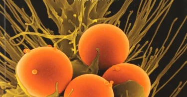 Pathophysiology 5th Edition