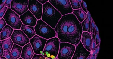 Developmental Biology, 13th Edition